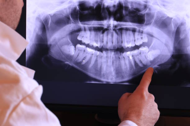 Best After-Hours Dental Trauma Care in Louisburg, NC