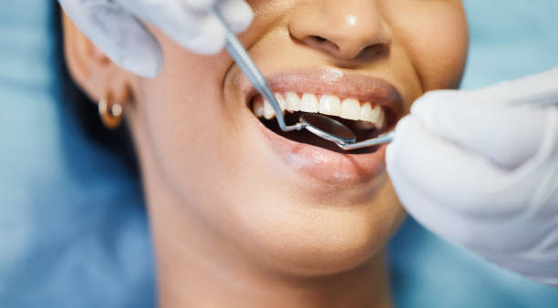 Best Emergency Gum Treatment in Louisburg, NC